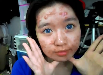 La technique d’Elaine Mokk pour cacher son acné