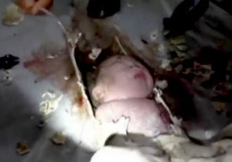Un bébé jeté dans les toilettes retrouvé vivant